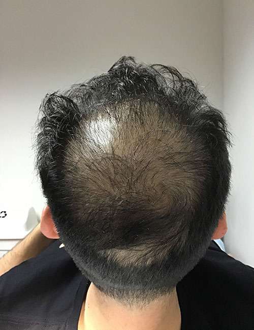 antes-2-cliente-dra-melisa-jimenez