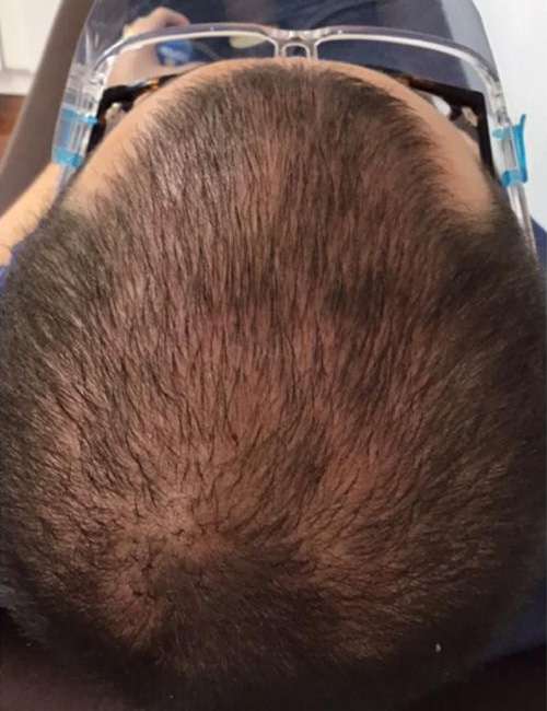 dra-melisa-jimenez-antes-01