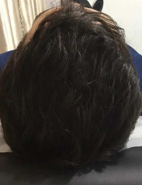 dra-melisa-jimenez-despues-01